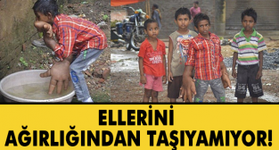 Elleri Her Geçen Gün Büyüyor !