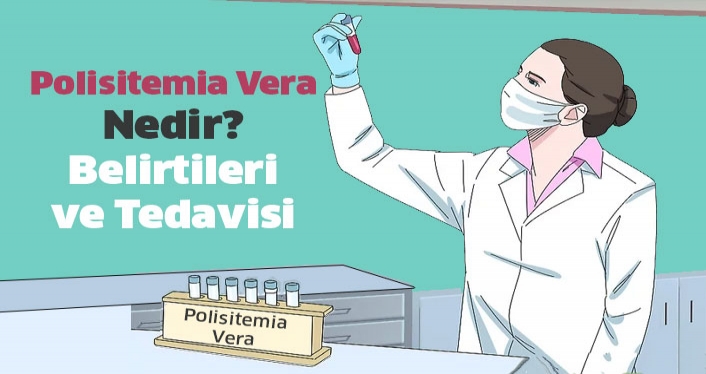 Polisitemia Vera Belirtileri ve Tedavisi