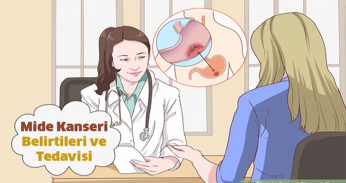 Mide Kanseri Belirtileri ve Tedavisi