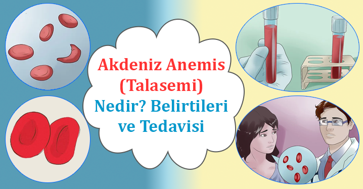 Talasemi - Akdeniz Anemisi Nedir? Belirtileri ve Tedavisi